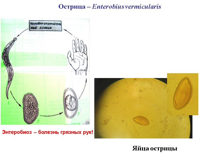 Острица – Enterobius vermicularis  Яйца острицы Энтеробиоз – болезнь грязных рук!